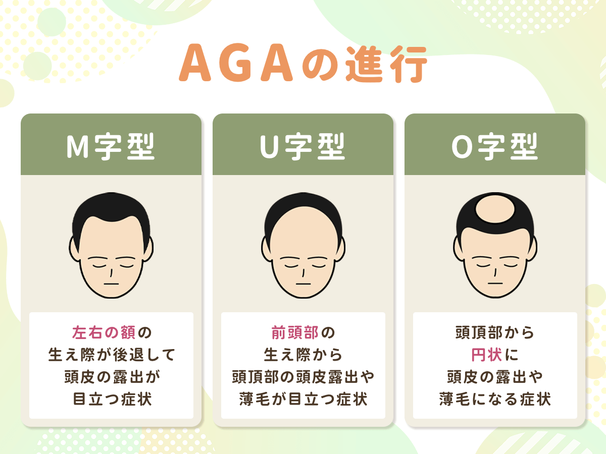 AGAが進行する症状・頭皮の状況